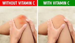 Vitamin C là gì? Những dấu hiệu cho thấy cơ thể thiếu vitamin c hãy bổ sung ngay nhé.